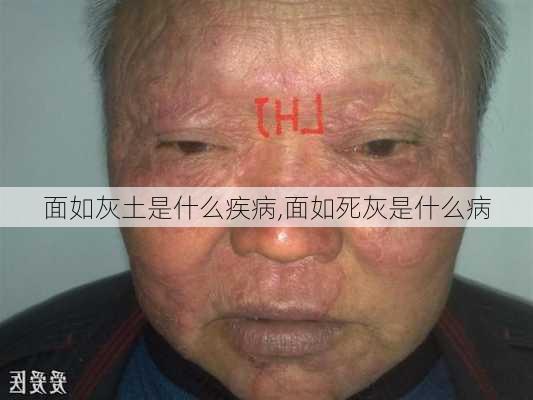 面如灰土是什么疾病,面如死灰是什么病