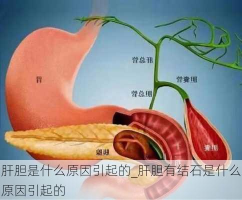 肝胆是什么原因引起的_肝胆有结石是什么原因引起的